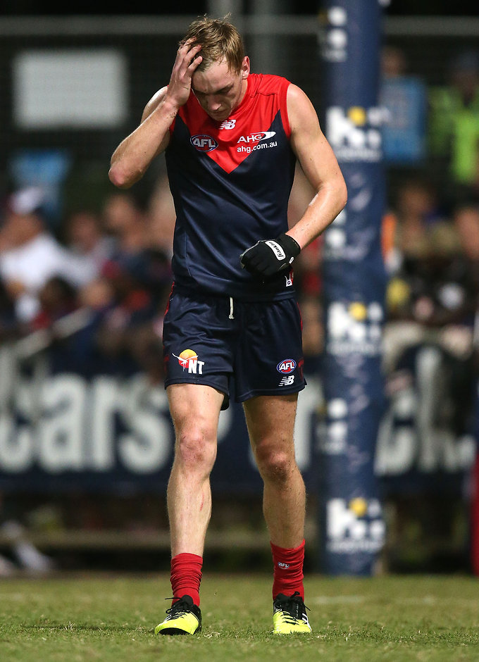 AFL 2016 Rd 16 - Melbourne v Fremantle DARWIN, AUSTRALIA - JULY 09: Oscar McDonald of the Demons limps off injured during the 2016 AFL Round 16 match between the Melbourne Demons and the Fremantle Dockers at TIO Stadium on July 9, 2016 in Darwin, Australia. (Photo by Justine Walker/AFL Media)
